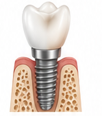 Best Dentist Near Me - Re-Hab Dental - dr-rohit-yadav 1
