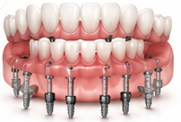 Best Dentist Near Me - Re-Hab Dental - dr-rohit-yadav 2