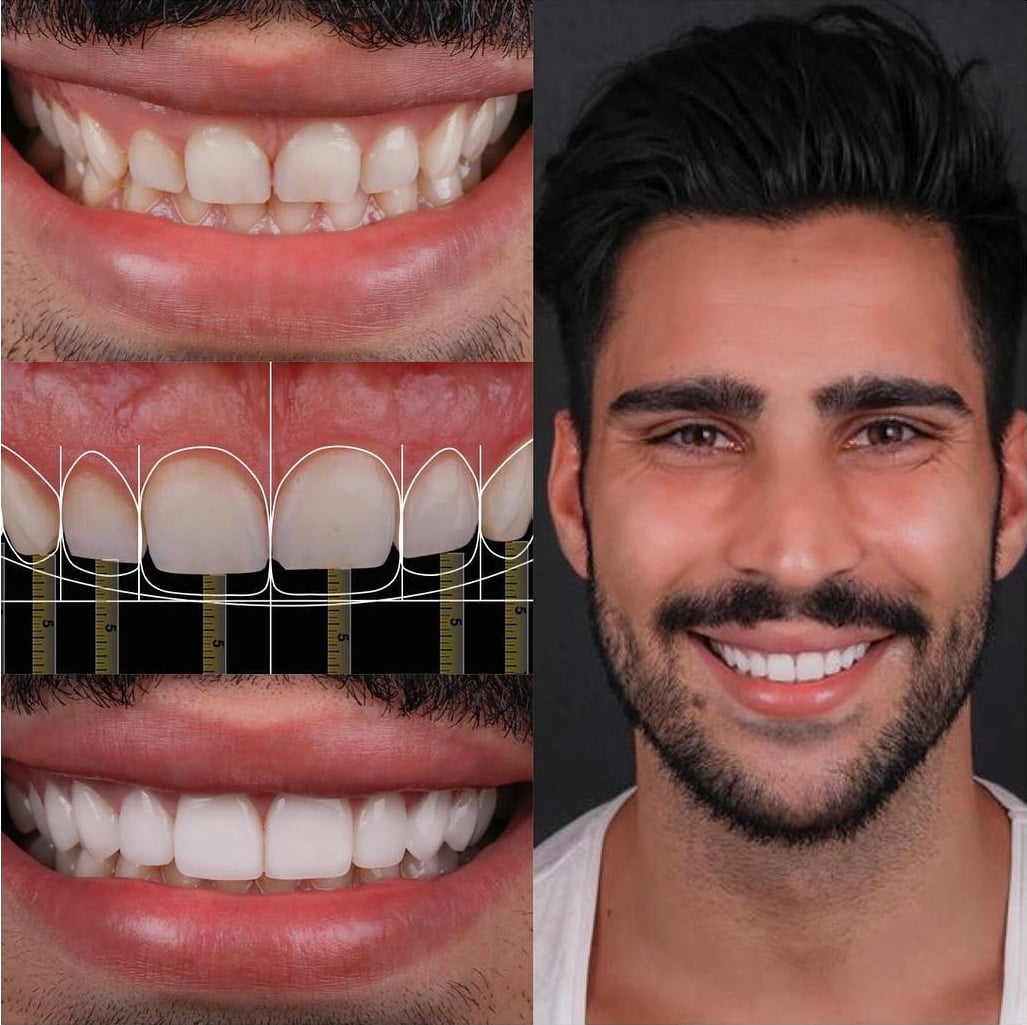 Dentist Near Me - Best Dental Clinic - Digital Smile Design