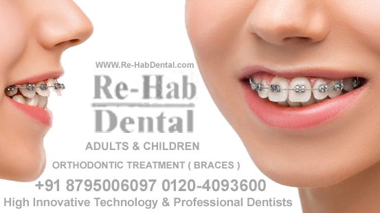 Dentist Near Me - Best Dental Clinic - ORTHODONTIC & BRACES TREATMENT