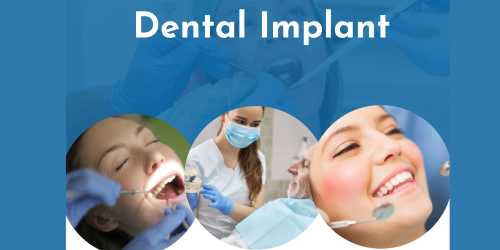 Experience Exceptional Dental Care With The Best Dentist In Rajnagar