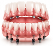 Best Dentist Near Me - Re-Hab Dental - dr-rohit-yadav 3