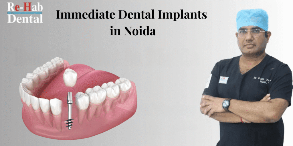 Best Dentist Near Me - Re-Hab Dental - Discover Immediate Dental Implants in Noida with Dr. Rohit Yadav – A Trusted Name in Modern Implantology Dental implants for missing teeth, permanent tooth replacement, advanced implant dentistry, full mouth dental restoration, best dental clinic for implants