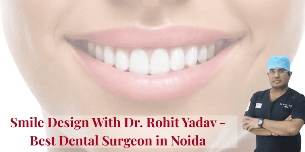 Smile Design With Dr. Rohit Yadav – Best Dental Surgeon in Noida