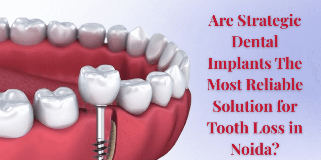 Strategic Dental Implants – Immediate Loading & Full Mouth Fixed Teeth Solution