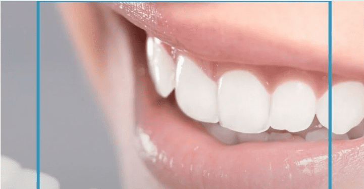Best Dentist Near Me - Re-Hab Dental - Five Essential Facts About Teeth Whitening You Should Know Best Teeth Whitening Treatment | Professional Dental Care | Brighter Smile | Cosmetic Dentistry | Expert Dentist