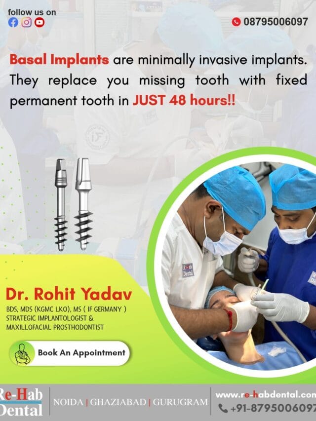 Minimally Invasive Basal Dental Implants for Fast and Painless Tooth Replacement