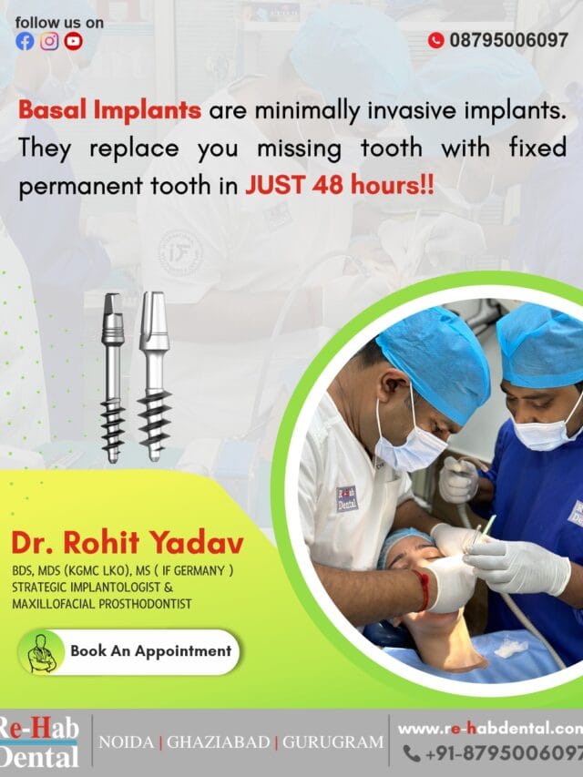 Best Dentist Near Me - Re-Hab Dental - Stories Discover Basal Implants The Future of Secure and Effective Tooth Replacement