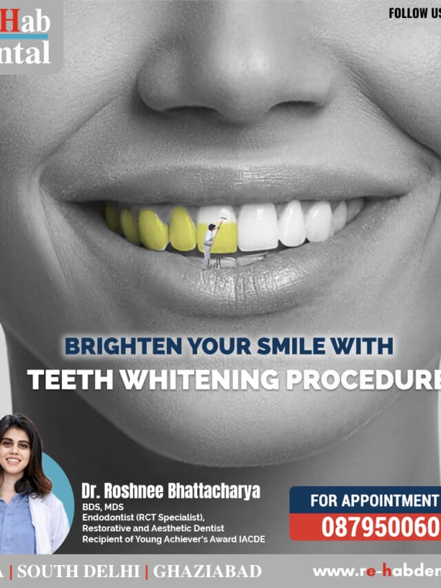 Best Dentist Near Me - Re-Hab Dental - Stories Get a Radiant Smile – Professional Teeth Whitening for Instant Results
