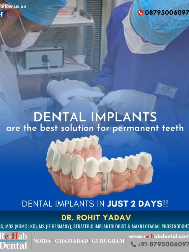 Best Dentist Near Me - Re-Hab Dental - Stories Say Hello to Permanence: Dental Implants for Permanent Teeth