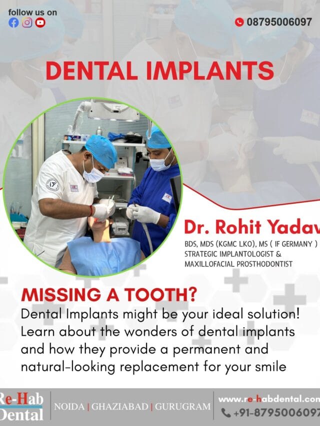 Best Dentist Near Me - Re-Hab Dental - Stories Ultimate Dental Implants Perfect Fix for Superior Smile Transformation