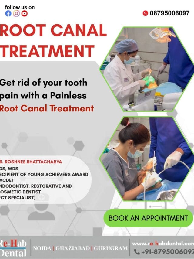 Painless Root Canal Treatment – Say Goodbye to Tooth Pain with Expert Dental Care