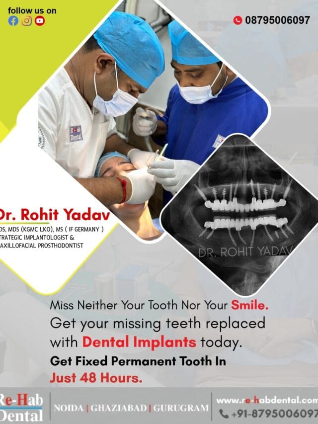 Replace Missing Teeth in 48 Hours with Dental Implants – Permanent Smile Restoration