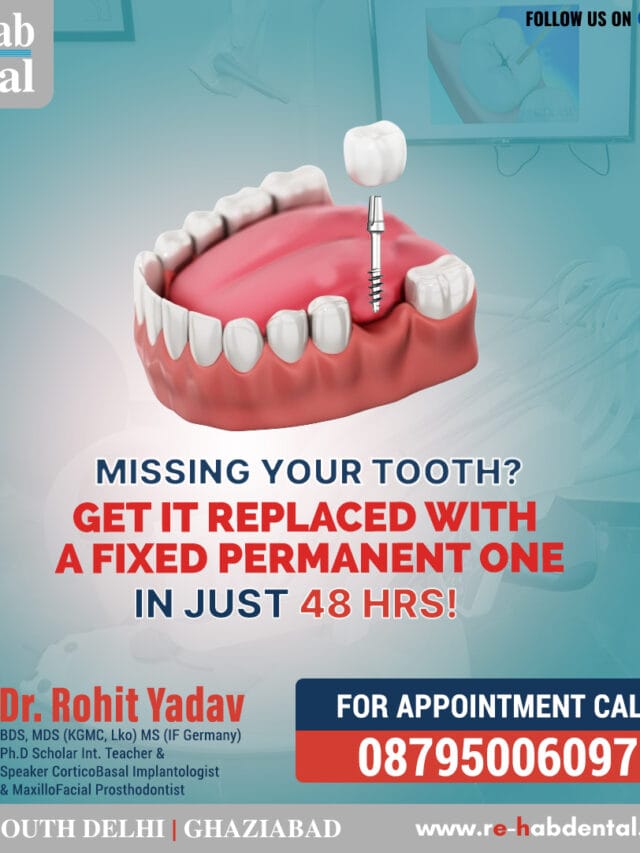 Best Dentist Near Me - Re-Hab Dental - Stories Permanent Dental Implant Solutions for Missing Teeth Achieve Your Perfect Smile