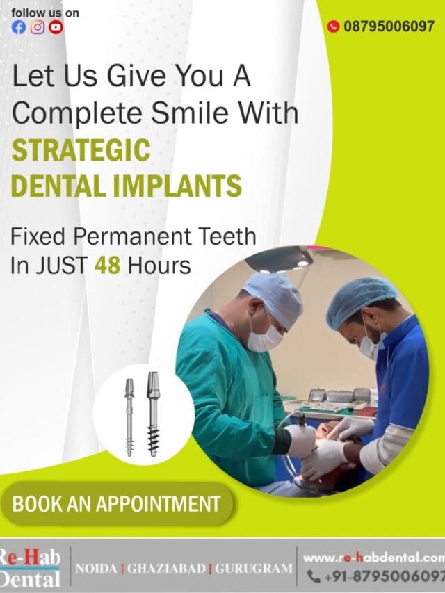 Restore Your Smile with Strategic Dental Implants – Fast, Permanent & Graft Free Teeth Replacement