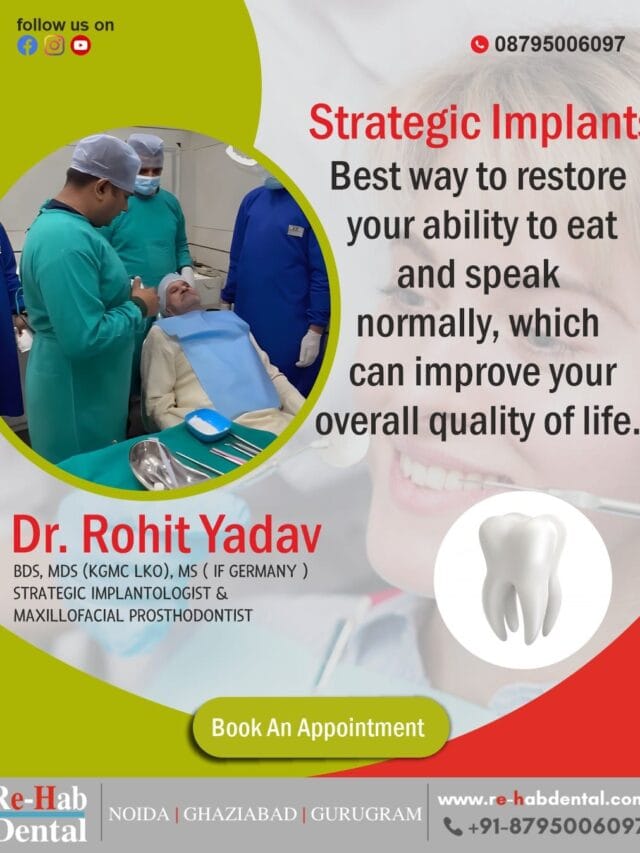 Permanent Tooth Replacement With Strategic Dental Implants – Safe, Fast & Affordable Solutions