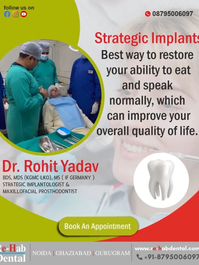Strategic Dental Implants for Immediate, Graft Free Tooth Replacement