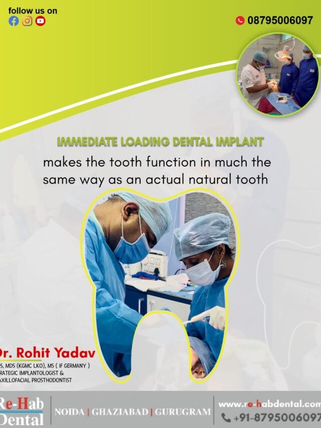 Best Dentist Near Me - Re-Hab Dental - Stories Best Immediate Loading Dental Implants – Fast & Permanent Tooth Replacement